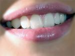 Gesundheit  wei�e Z�hne strahlendes L�cheln Geldsparen.de